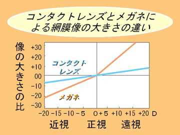 コンタクトのイラスト3 コンタクトレンズとメガネによる網膜像の大きさの違い